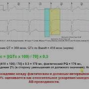Интервал и сегмент PQ корригированный PQc индекс PQs