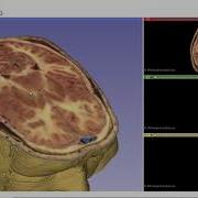 Demonstration Of The Major Motor Structures Using Data From The Visible Human Project