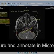 How To Measure And Annotate DICOM Images In MicroDicom DICOM Viewer Tutorial