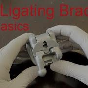 Self Ligating Brackets