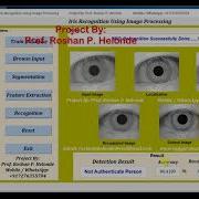Iris Recognition Using Image Processing Matlab Project Source Code Final Year Project