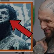 Alex Terrible Explains The Scar On His Face