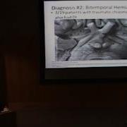 Hemifield Slide ARCHIVE