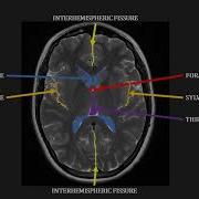 Introduction To MRI Of The Brain