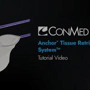Anchor Tissue Retrieval System CONMED Tutorial Video