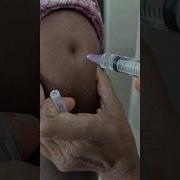 IM Injection Veyadam Ela Intramuscular Injection Arm Injection Doctor Medical Pharmacy Trendingshort