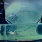 CRV Flow Conditioning Technology Solves Flow Problems