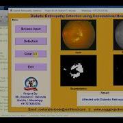 Matlab Code For Diabetic Retinopathy Detection Using Convolutional Neural Network CNN