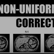 FireVoxel Tutorial 7 Introduction To MRI Non Uniformity Correction