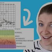 How To Read An Audiogram