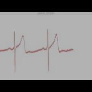 Sample ECG Data