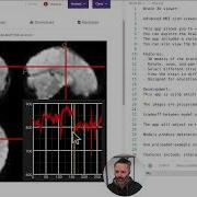 Exploring Open Source Brain MRI Data With Python Building A 3D MRI Viewer Using Flask