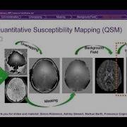 An Overview On Quantitative Susceptibility Mapping QSM For The ISMRM Educational Session 2021