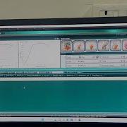 Compression Test Of PLA Using Universal Testing Mechine UTM