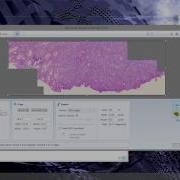 Microscope Photography Stitching With Microsoft ICE