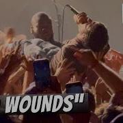 PUP Old Wounds LIVE