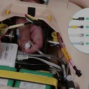 SimMan 3G How To Remove The Compressor Leg
