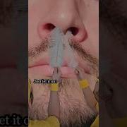 How The Sun Makes You Sneeze Shorts