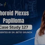 Case Study 127 Choroid Plexus Papilloma Explained By Dr Grunch Pediatric Brain Tumor