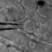 Cleaning The Mouse Retina For Patch Clamp Recording