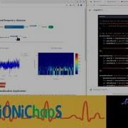 EEG Spectrogram A Python Flask EEG Analysis Tool Development Part 2