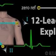 12 Lead ECG Explained Animation