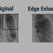Image Filters Smoothing Filter Edge Enhancement Filters