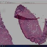 Segment Anything Model In QuPath