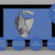 CephX 3D Segmentation