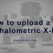 How To Upload A 2D Cephalometric X Ray With CephX