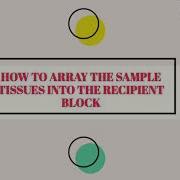 Tissue Microarray