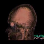 Volumetric Rendering Of Human CT Scan