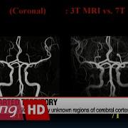 New Brain Map Identifies Nearly 100 New Areas