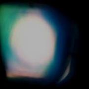 Moire Projector Prototype