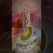 Acid Reflux Explained