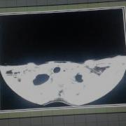 Doctor Multi Touch Table Part2