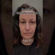 Facelift Naturally Face Fitness Face Yoga Face Massage