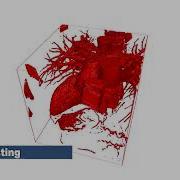 GPU Based Volume Rendering