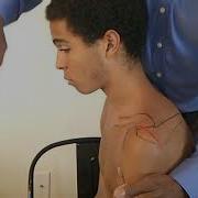 Stiff Shoulder Surface Anatomy