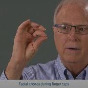 Impact Of HD Chorea Examples Of Movement