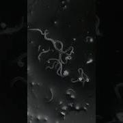 Dust In Our Nails In Microscope View Shorts Microscope Nails Germs