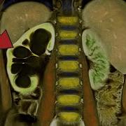 A Man Inhaled Paint Thinner And It Ruined His Life