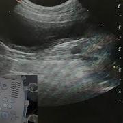 Optimising Your Ultrasound Image