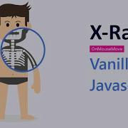 Awesome X Ray Of Cartoon Image Using JavaScript How To Get X Ray Using JavaScript Clip Path Css