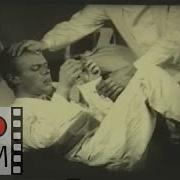 Шизофрения кататонический синдром ступор лечение Catatonic Syndrome Catatonia Stupor