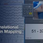 Translational Brain Mapping In Brain Tumor Surgery