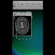 3D моделирование в ImageJ потрясающе 3dмоделирование обработкаизображений