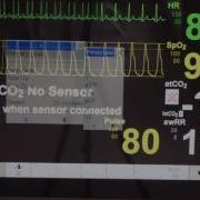 Patient Monitor Tutorial