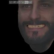 Patient Specific Motion And Bellus3D Dental Pro