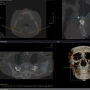 General Tool General Output Capture BMP Export